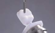 Dental & Medical: Glass Ceramic crowns & bridges